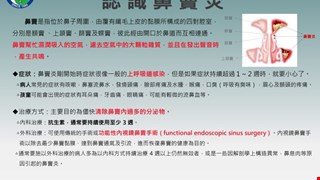 認識鼻竇炎/9K