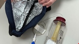 How to Use the Portable Home-based Chemotherapy Infusion Device 如何使用攜帶式居家化療輸液器