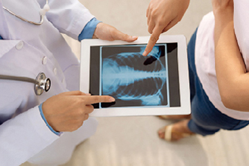 Tim Kanker Paru-paru