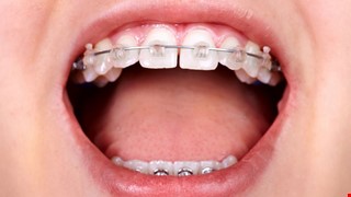 Tongue color changes within a menstrual cycle in eumenorrheic women.