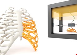 迎接數位醫療新浪潮 手術到復健3D列印無所不在