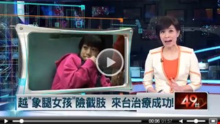 越南「象腿女孩」險截肢　來台治療成功！