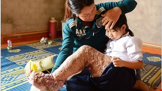 Hành trình đứng lên phi thường của cô bé “chân voi” ở Tây Nguyên