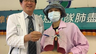 婦人咳1年不癒竟是肺癌第4期 精準醫療存活至今逾4年