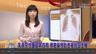 乳房惡性腫瘤第四期  標靶藥物助患者找回生機