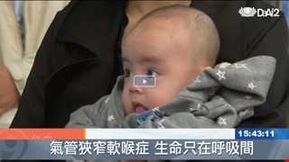 先天氣管狹窄 越南早產男嬰來台治療
