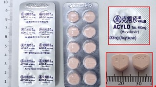 口服抗疱疹病毒劑acyclovir 400 mg/Tab放寬健保給付規定