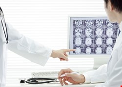救腦最前線 腦中風的外科治療