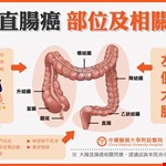 大腸癌部位及相關症狀-大腸直腸癌懶人包3