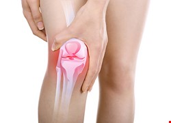 膝關節退化 治療對策大剖析