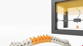 3D列印定位準 整治脊椎大利多