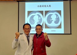 合併化療及免疫治療 肺腺癌治療新選擇