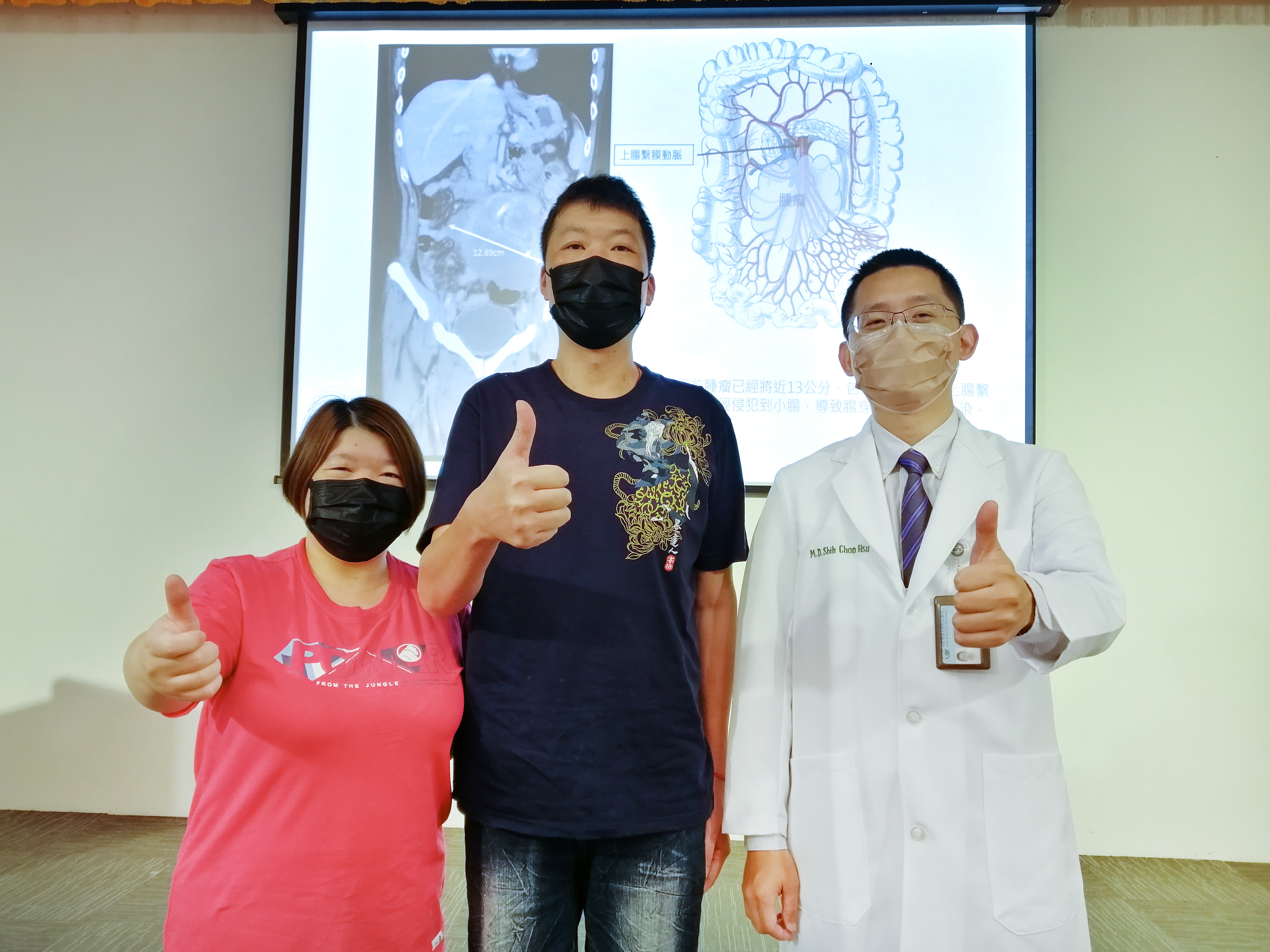 小腸移植改善進食！39歲男戰勝侵襲性腹內類結節纖維瘤