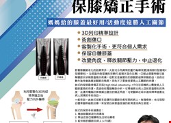 保膝免換膝！ 3D列印HTO保膝矯正手術