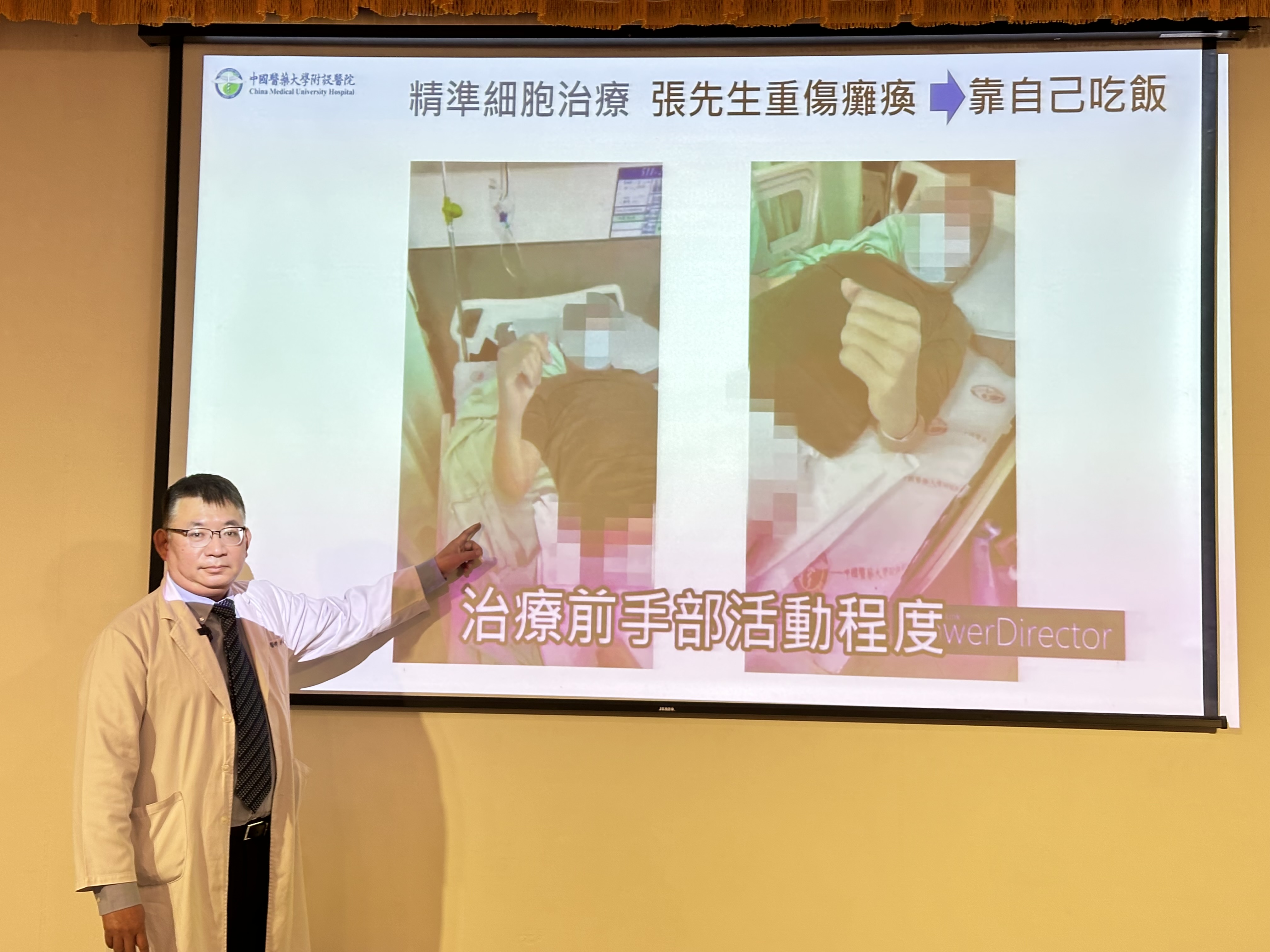 登山意外重傷全身癱瘓 細胞治療逆轉脊髓再生 半年後能靠自己吃飯