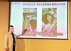 登山意外重傷全身癱瘓 細胞治療逆轉脊髓再生 半年後能靠自己吃飯