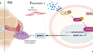 Nesfatin-1 stimulates BMP5 expression and osteoclastogenesis in rheumatoid arthritis
