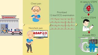 Implementation of an All-Day Artificial Intelligence-Based Triage System to Accelerate Door-to-Balloon Times