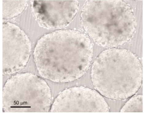 Patient-derived tumor organoids as a platform of precision treatment for malignant brain tumors img