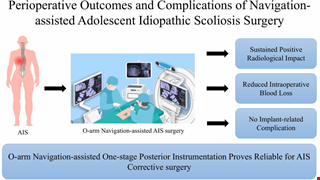 Navigation-Assisted One-Staged Posterior Spinal Fusion Using Pedicle Screw Instrumentation in Adolescent Idiopathic Scoliosis—A Case Series