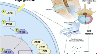 High glucose enhances fibrosis in human annulus fibrosus cells by activating mTOR, PKCδ, and NF-κB signaling pathways