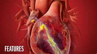 Cryothermal Energy Demonstrates Shorter Ablation Time and Lower Complication Rates Compared with Radiofrequency in Surgical Hybrid Ablation for Recurrent Ventricular Tachycardia