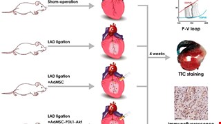 PD-L1 and AKT Overexpressing Adipose-Derived Mesenchymal Stem Cells Enhance Myocardial Protection by Upregulating CD25+ T Cells in Acute Myocardial Infarction Rat Model