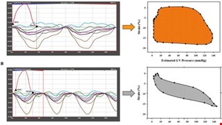 Estimated left ventricular pressure-myocardial strain loop as an index of cardiac work predicts all-cause mortality in patients receiving regular hemodialysis