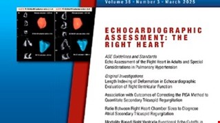 Three-dimensional Echocardiographic Assessment of Mitral Annular Physiology in Patients with Degenerative Mitral Valve Regurgitation Undergoing Surgical Repair: Comparison between Early- and Late-Stage Severe Mitral Regurgitation