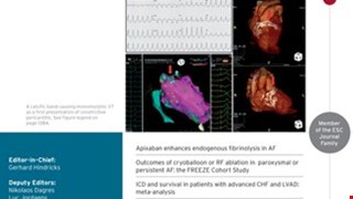 A novel atrial fibrillation prediction model for Chinese subjects- A nationwide cohort investigation of 682,237 study participants with random forest model