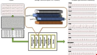 Usefulness of Machine Learning Based Detection and Classification of Cardiac Arrhythmias with 12 Lead Electrocardiograms