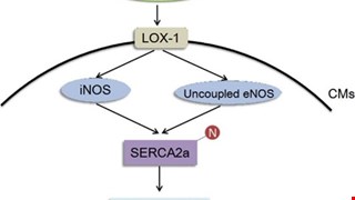 Increased LDL electronegativity in chronic kidney disease disrupts calcium homeostasis resulting in cardiac dysfunction