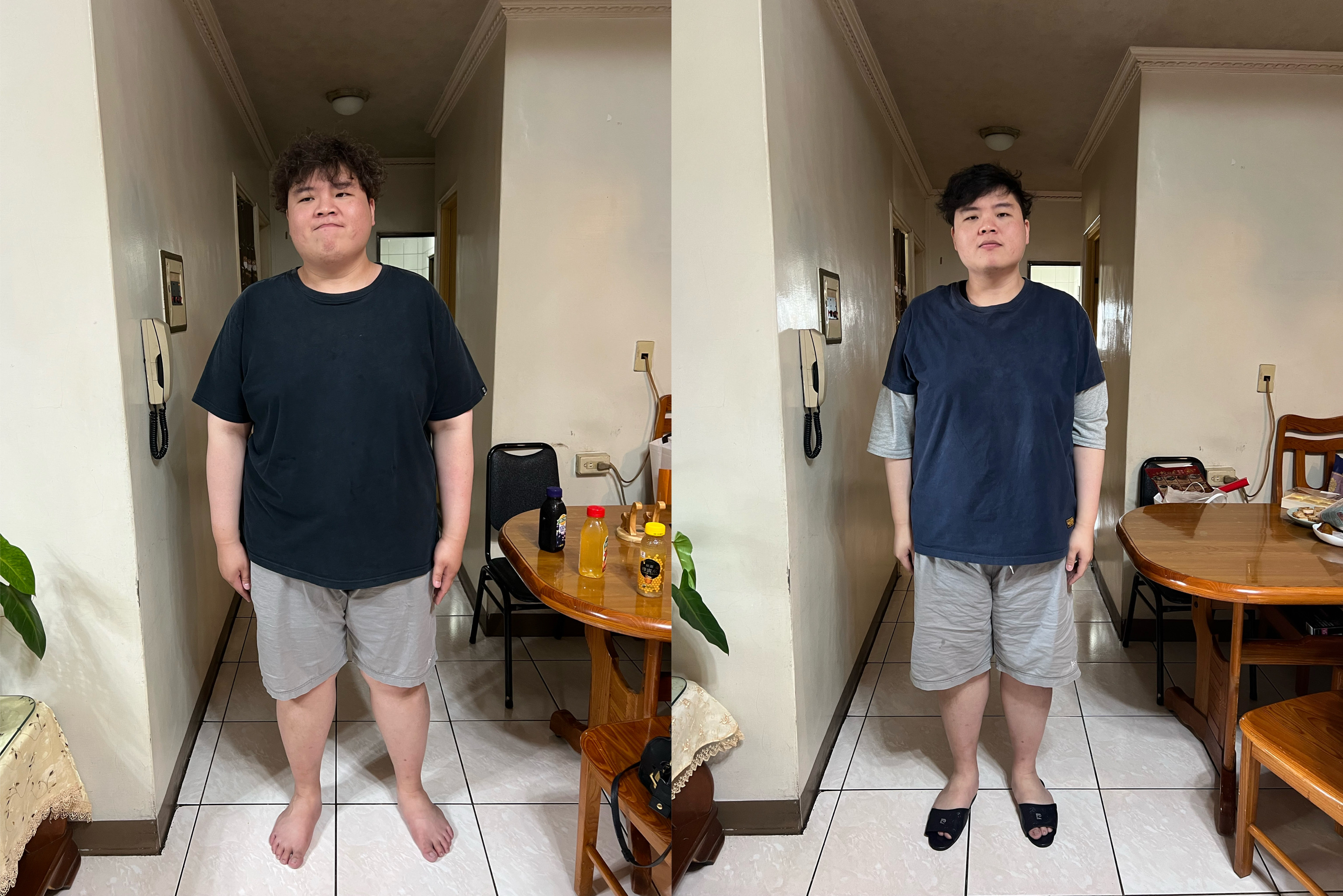 逾百公斤胖男「胃鏡縮胃」減重 ４個月甩22公斤