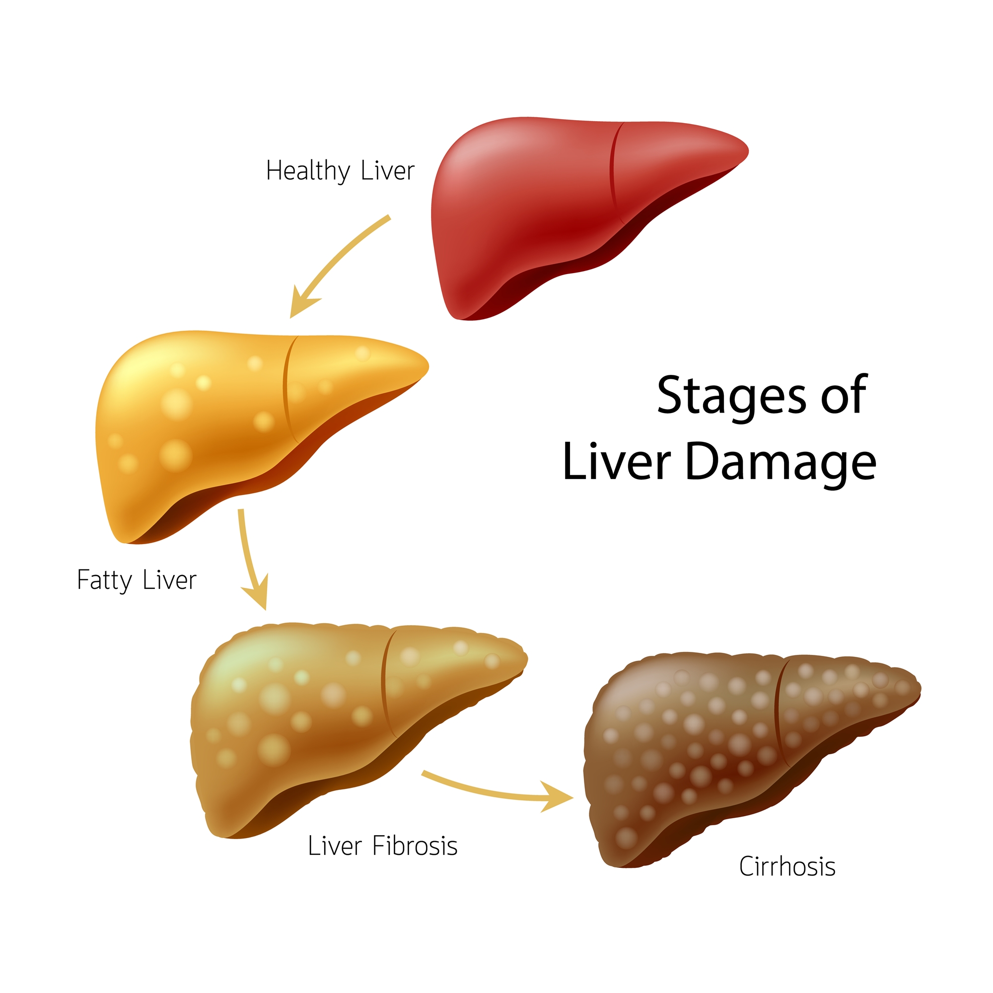 liver-cirrohsis-china-medical-university-hospital